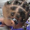 南加州大学人工耳蜗植入计划